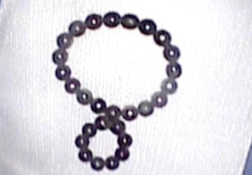 2歲幼童誤吞28顆磁力珠 CT照片曝光實(shí)在是太嚇人了