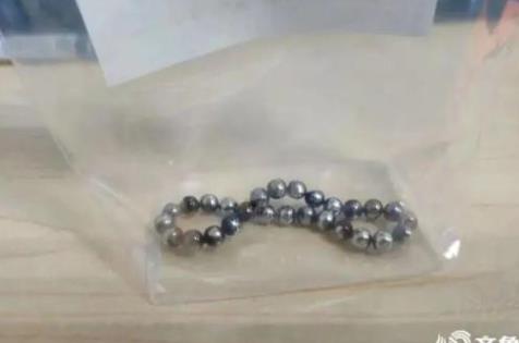 2歲幼童誤吞28顆磁力珠 CT照片曝光實(shí)在是太嚇人了