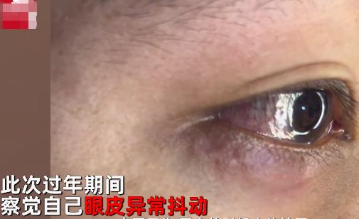 男子左眼皮異常抖動有蟲游走 到底是什么情況?