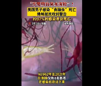美國男子自來水洗臉感染食腦蟲死亡 為什么會這樣? 