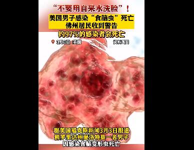 美國男子自來水洗臉感染食腦蟲死亡 為什么會這樣? 