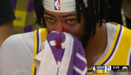 濃眉被打出血 背后真相曝光簡直太驚人了