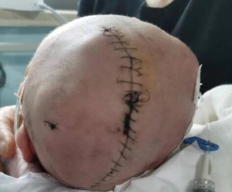 嬰兒出生后顱骨骨折 醫(yī)院回應(yīng) 真相曝光簡(jiǎn)直太驚人了