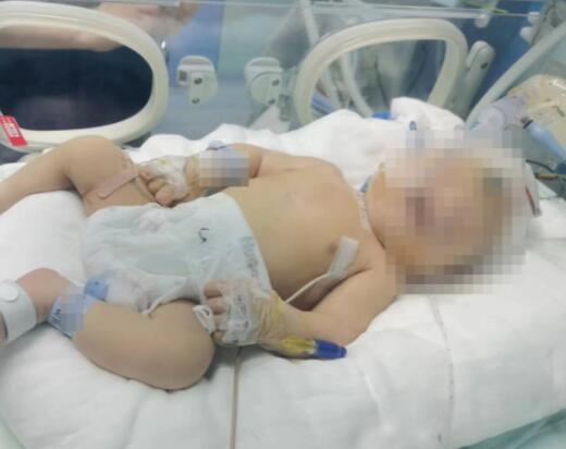 嬰兒出生后顱骨骨折 醫(yī)院回應(yīng) 真相曝光簡(jiǎn)直太驚人了