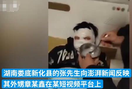 12歲男孩看短視頻學(xué)做火藥被炸傷 照片曝光直接讓人驚呆了
