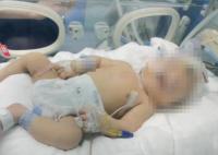 嬰兒出生后顱骨骨折 醫(yī)院回應(yīng) 真相曝光簡直太驚人了