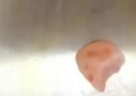 女子摔跤上牙磕進嘴唇1月后才發(fā)現(xiàn) 照片曝光實在是太嚇人了