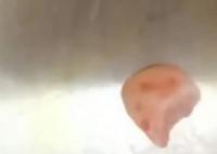 女子摔跤上牙磕進(jìn)嘴唇1月后才發(fā)現(xiàn) 照片曝光實(shí)在是太嚇人了