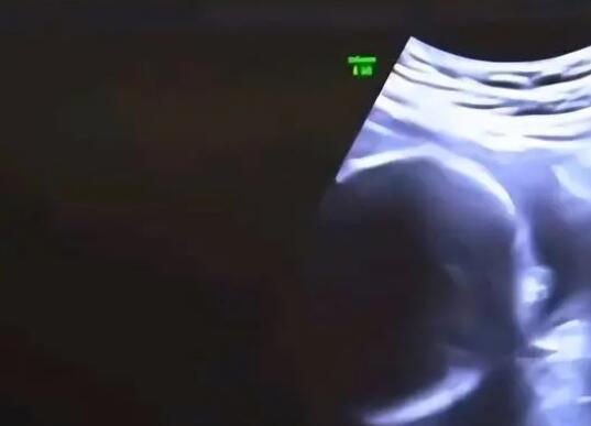 結(jié)婚6年沒孩子 查出丈夫非男性太嚇人了