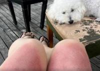 女子云南穿破洞褲7小時(shí)腿被曬傷 真相揭露真的令人大吃一驚