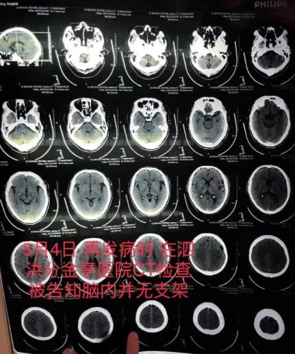 老人腦梗去世 醫(yī)生隱瞞未植入支架 事件始末是什么?