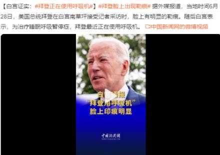 拜登使用呼吸機治療睡眠呼吸暫停 曾反復出現睡眠呼吸暫停問題 