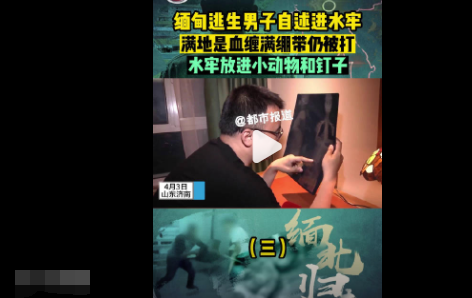 從緬甸逃回男子自述水牢滿地是血 簡直太嚇人了