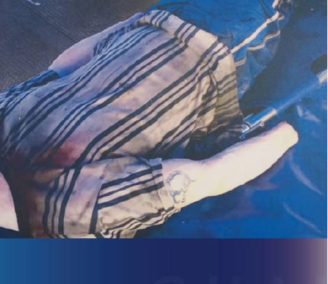 日本札幌一酒店驚現(xiàn)無(wú)頭男尸 赤身裸體頭部被刀具切斷帶走