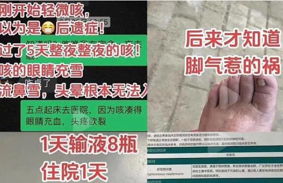 女子聞剛脫下的襪子感染真菌肺炎 咳嗽眼睛充血無法入睡太恐怖了