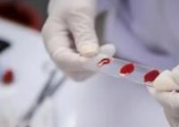 河北發(fā)現(xiàn)比“熊貓血”還罕見的血型 原因竟是這樣太罕見了