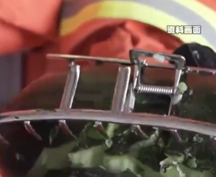 女子戴鯊魚夾騎電車摔倒致頭骨骨折 究竟是怎么回事？