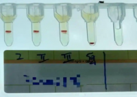 云南檢出一例全球罕見的小p血型 內(nèi)幕曝光簡(jiǎn)直太意外了