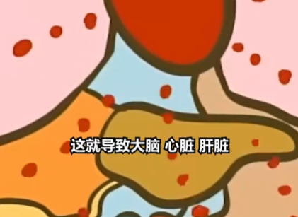 醫(yī)生:患熱射病時內(nèi)臟像被開水煮 簡直太可怕了