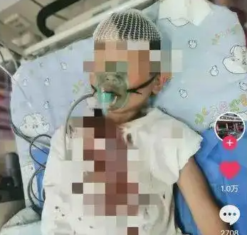 8歲男童被醉漢砸頭 或需做開顱手術(shù) 真相簡直太意外了