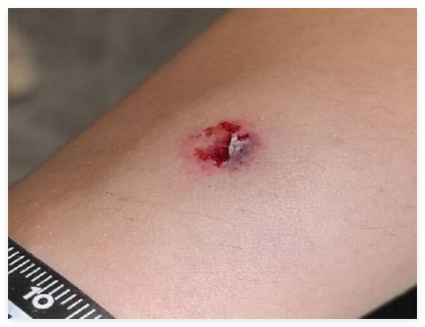 司機等紅燈向路人射鋼珠致4人受傷 背后真相實在讓人驚愕