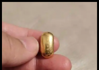 熊孩子誤吞10克金豆6天后排出 內(nèi)幕曝光簡直太意外了